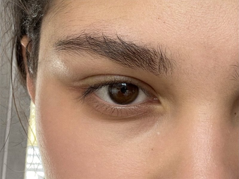 Deep-set eye, reference photo