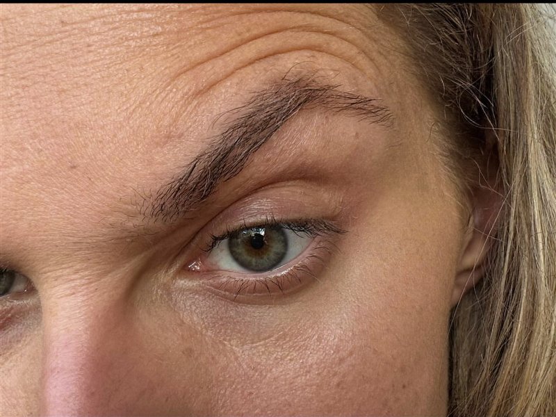 Hooded eye, reference photo