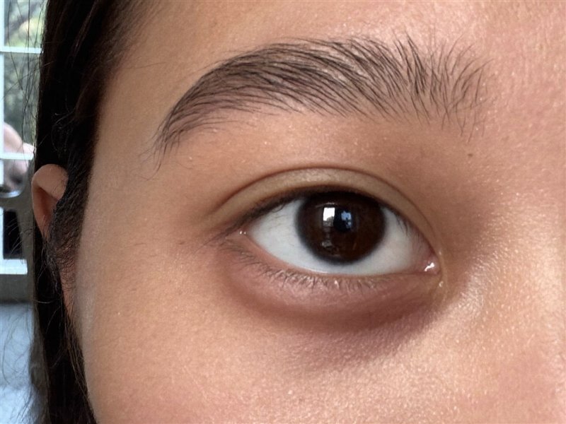 Round eye, reference photo