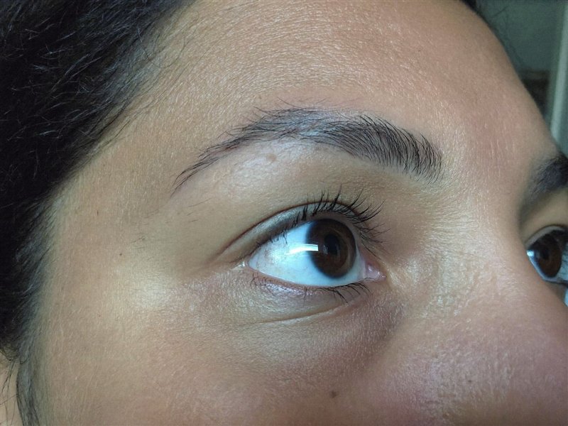 Upturned eye, reference photo
