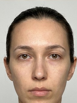 Oblong face shape, reference photo