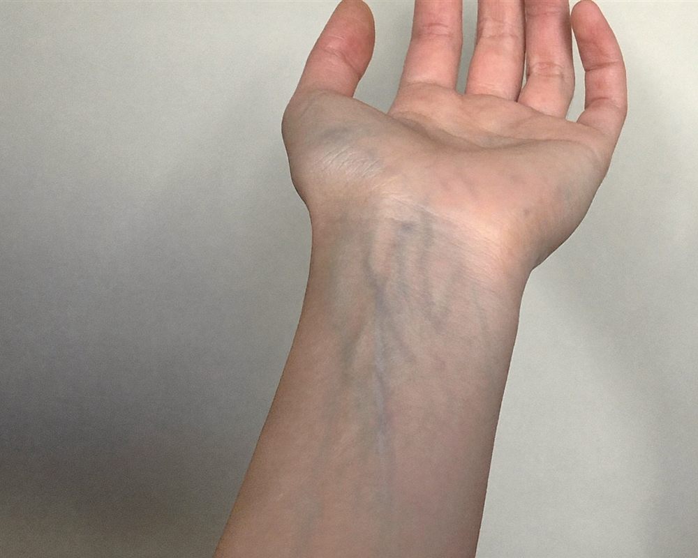 Inside of a wrist: veins look blue or purple