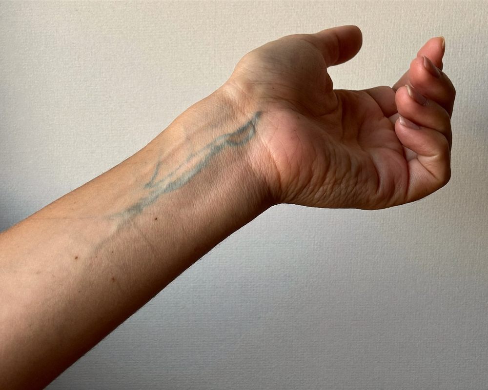 Inside of a wrist: veins look blue-green, hard to call