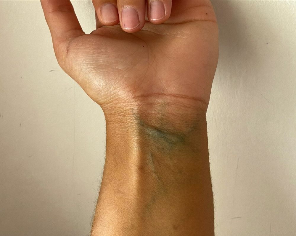 Inside of a wrist: veins look green
